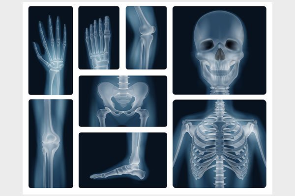 X Ray and Scanning Center in Madurai
