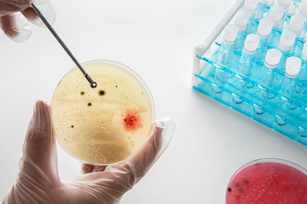 Best Ultrasound Scan Center in Madurai